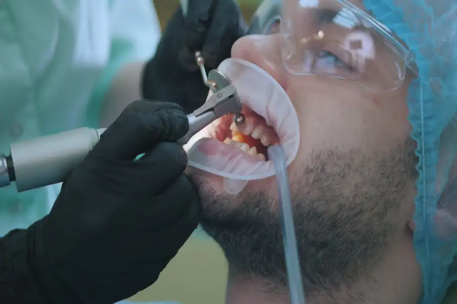 Benefits of Dental Restoration for Oral Health in Richmond, VA Benefits of Dental Restoration for Oral Health in Richmond, VA