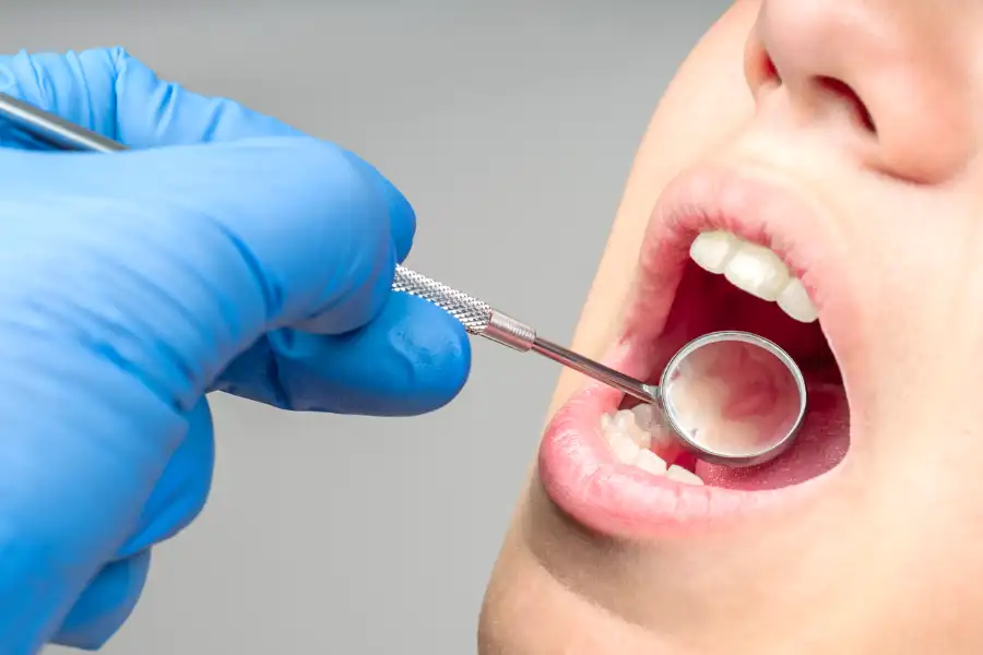 The Role of Dental Cleaning in Cavity Prevention in Richmond, VA The Role of Dental Cleaning in Cavity Prevention in Richmond, VA